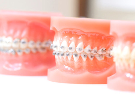 矯正専門 リーサ矯正歯科の装置装着