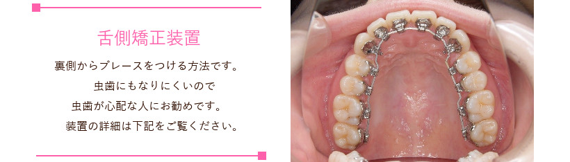 札幌市白石区南郷13丁目にあるリーサ矯正歯科 子どもの矯正