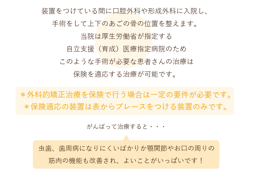矯正装置の種類